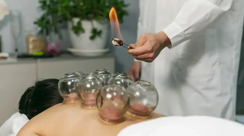 cupping banner