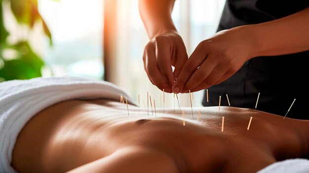 [freepicdownloader.com]-acupuncture-spa-salon-selective-focus-normal